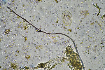 microorganisms and soil biology, with nematodes and fungi under the microscope. in a soil and...
