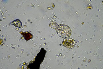 forest soil sample under the microscope looking at microorganisms and fungi