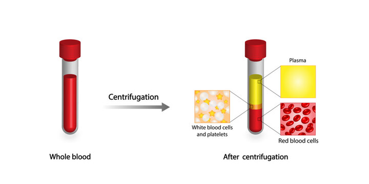 Blood centrifugation. Platelets, red blood (erythrocytes) and white blood cells (leukocytes). Platelet-rich plasma (prp). Medical test tube, Glassware or flask. Vector educational illustration