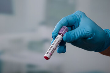 hand in blue glove holding a blood test tube in front of a lab room