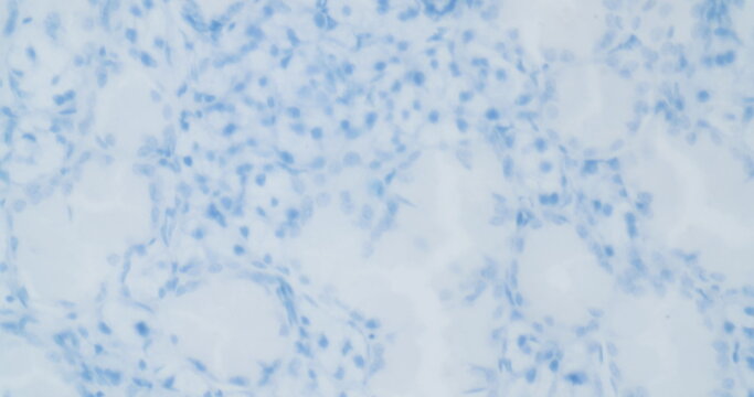 virus structure under a microscope