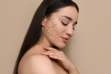 Beautiful young woman with dry skin on beige background