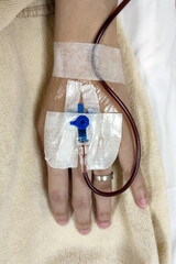 Close up of IV infusion injection on hand for medical and healthcare industry background concept