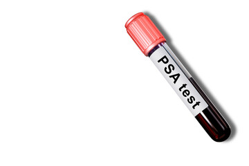 PSA test. Test tube with blood. Patient PSA analysis. Determination of level of prostate specific antigen. Plastic flask with PSA inscription. Medical test tube isolated on white. Prostate treatment
