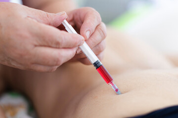Injecting vitamin B with syringe - close up shallow focus