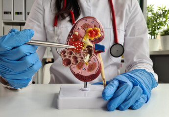 Doctor holding anatomical model of adrenal gland kidney