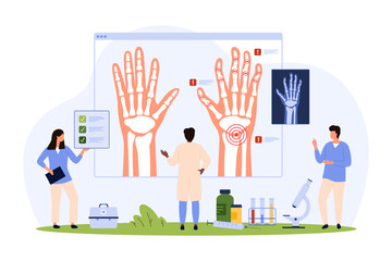 Rheumatoid arthritis, osteoarthritis, rheumatism of wrist and fingers diagnosis vector illustration. Cartoon tiny people research xray of patients hands with autoimmune disease, joint inflammation
