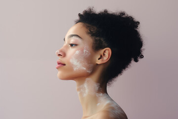 Profile portrait of a woman with vitiligo on a pastel background. Celebrating diversity and natural beauty. Desugn for poster, banner, or backdrop. Minimalistic and simple - obrazy, fototapety, plakaty