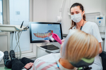 Dentist female doctor in uniform showing scan of intraoral 3D dental scanner Machine to patient. Dental clinic patient visit modern medical ward. Health teeth care, medicare Clear aligners industry.