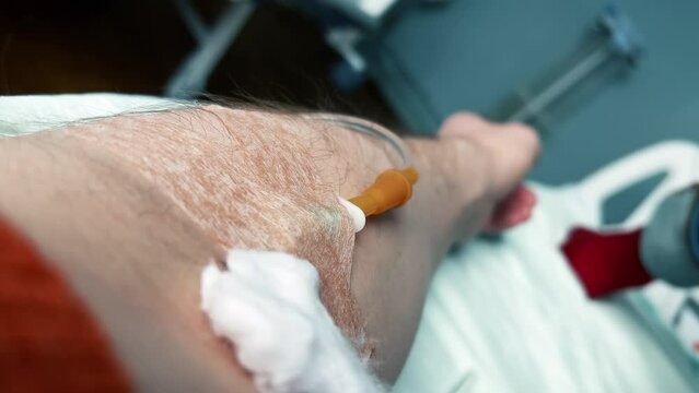 POV of a man's arm with an IV needle in the median cubital vein (antecubital vein). Man is receiving intravenous fluid. Intravenous injections, medical care in a clinic. Recovering patient