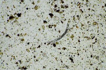 microscopic forest fungal hyphae in a soil sample