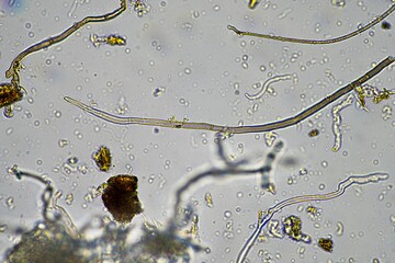microorganisms and soil biology, with nematodes and fungi under the microscope. in a soil and...