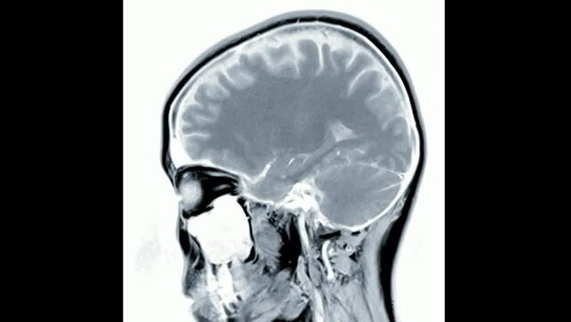 CT Brain scan image MRI human anatomy disease research healthy adult male caucasian