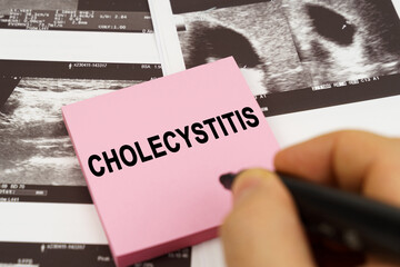 On the ultrasound pictures there are stickers that say - Cholecystitis