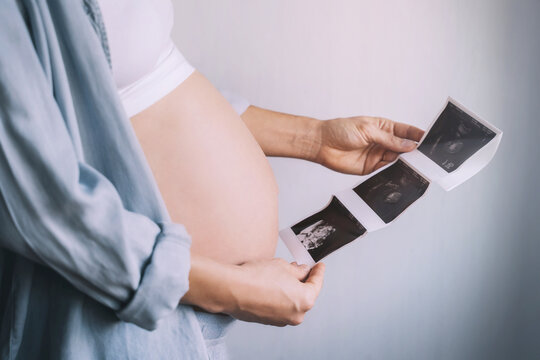 Pregnant woman holding ultrasound images. Pregnancy concept.