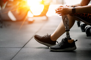 prosthetic, artificial leg. Woman with prosthetic leg using walking on treadmill while working out in gym. artificial leg. Woman wearing prosthetic equipment sit down after exercising  in gym. - obrazy, fototapety, plakaty