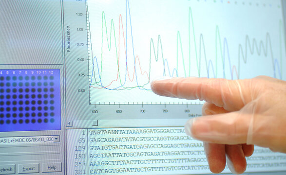 Sequencing of human DNA in a computer screen at a hospediatric research center highlighting the RNA nitrogen bases: adenine, guanine, cytosine and thymine