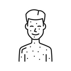 Baby boy with skin rash, hives, irritation or chickenpox measles. Vector food, medication allergy reaction thin line icon. Skin disease, itching rashes