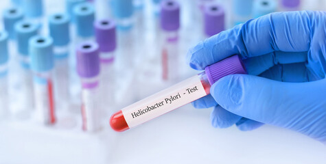 Doctor holding a test blood sample tube with Helicobacter Pylori test on the background of medical test tubes with analyzes - obrazy, fototapety, plakaty