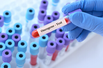 Doctor holding a test blood sample tube with oncogene test on the background of medical test tubes with analyzes - obrazy, fototapety, plakaty