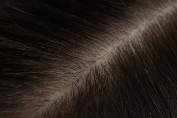 Man with healthy dark hair, macro view