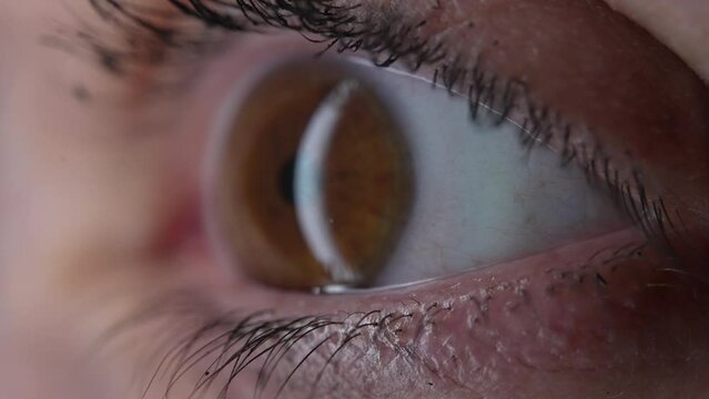 Macro closeup eyeball opening EYE wide open, tight detail or iris retina, SURPRISE reaction