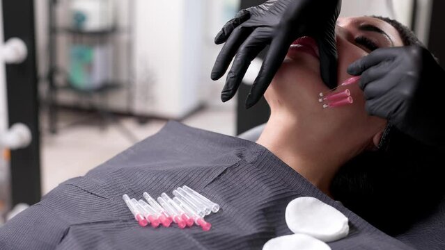 An adult woman undergoes a thread lifting procedure in a cosmetology clinic. Anti-aging facial rejuvenation. A cosmetologist implants cosmetic threads under the skin to eliminate facial ptosis.