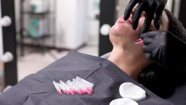 An adult woman undergoes a thread lifting procedure in a cosmetology clinic. Anti-aging facial rejuvenation. A cosmetologist implants cosmetic threads under the skin to eliminate facial ptosis.