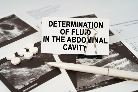On the ultrasound pictures there is a business card with the inscription -determination of fluid in the abdominal cavity