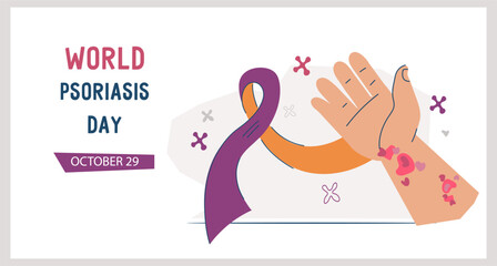Psoriasis skin diseases awareness day banner template for website. Psoriasis treatment and support for patients, vector illustration.