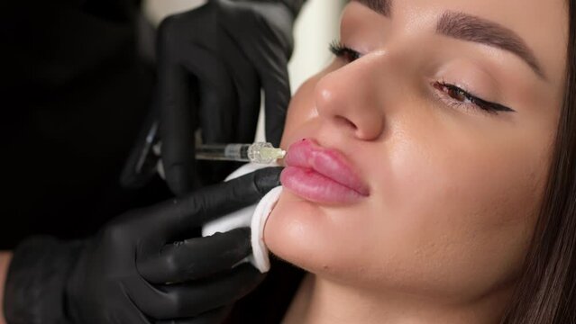 Surgeon, in medical gloves, carefully and slowly injects hyaluronic acid into woman's lips with a syringe. lip augmentation procedure. beauty injections. Plastic surgery.