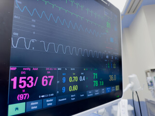hospital monitor displaying vital signs and hemodynamics, illustrating healthcare and patient...