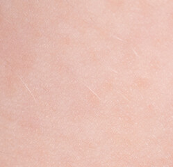 Close-up of a girl's skin. Macro