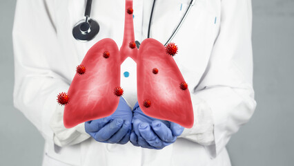 The doctor shows a man's lungs. Infectious tuberculosis, lung cancer, mycoplasma respiratory...