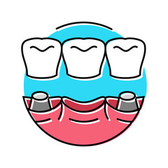 bridge dental procedure color icon vector. bridge dental procedure sign. isolated symbol illustration