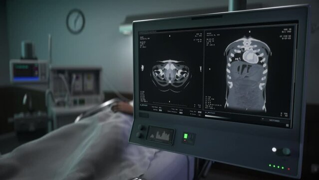 Human Skeleton Imaging For Cancer Disease Diagnostic On Screen. Human Skeleton Diagnostic By Medical Clinic Device. Human Skeleton Diagnostic Imaging. Health Examination. Analysis. Anatomy