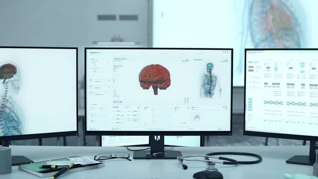 Medical X-ray system deals with the analysis of the brain. X-ray scanner analysing the brain for disease cell. Identifying the deadly tumour after the x-ray brain analysis at hospital. Healthcare