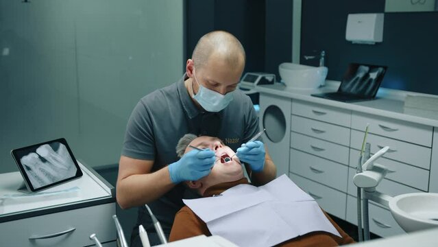 Bald dentist in medical mask examining male patient, mouth wide open in semi-sitting position using tooth scraper and concave mirror in cozy dentist office. High quality 4k footage