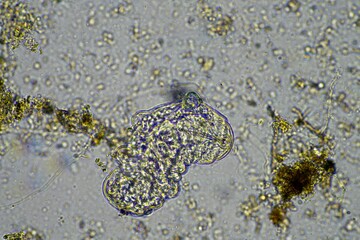 microorganisms and a tardigrade in a soil sample on a farm under the microscope