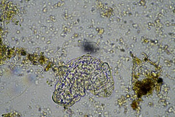 microorganisms and a tardigrade in a soil sample on a farm under the microscope