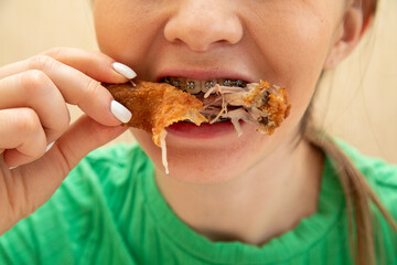 Closeup of woman in dental braces eating chicken drumsticks