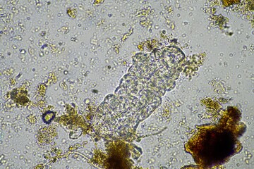 microorganisms and a tardigrade in a soil sample on a farm under the microscope