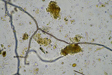 soil microbes under the microscope. microorganisms with fungus