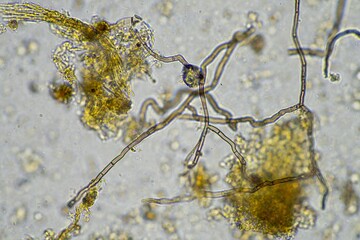 microscopic microorganisms under the microscope in a soil sample