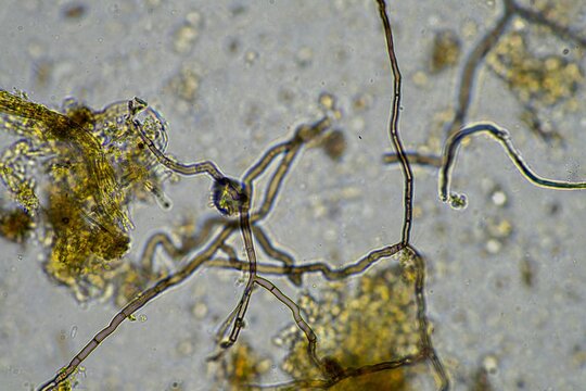 microscopic fungus and microorganisms in a sample