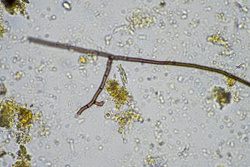 microscopic microorganisms under the microscope in a soil sample