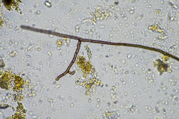 microscopic microorganisms under the microscope in a soil sample