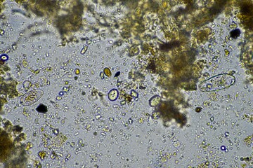soil microbes under the microscope. microorganisms with fungus