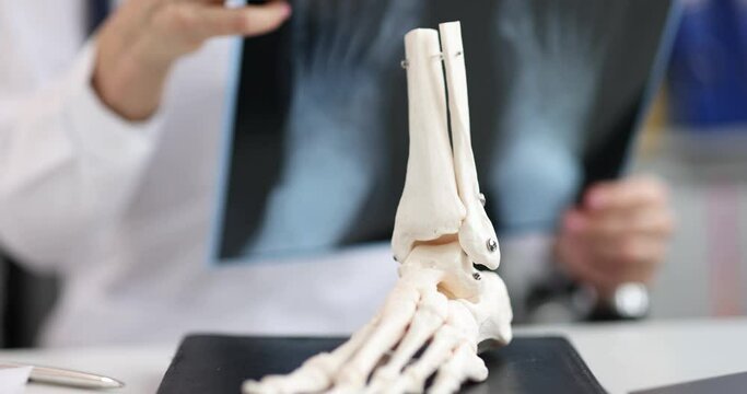 Trauma surgeon evaluates x-rays of legs. Skeletal foot symptoms and treatment concept