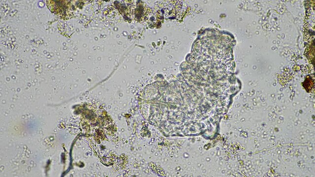 soil microorganisms under the microscope, including, fungi hyphae